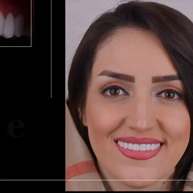نمونه کار دندانپزشکی